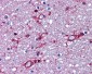 APP / Beta Amyloid Antibody (aa737-751)